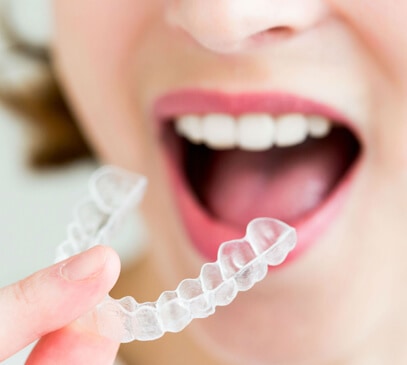 Invisalign and clear aligners - Tarneit Dental Care