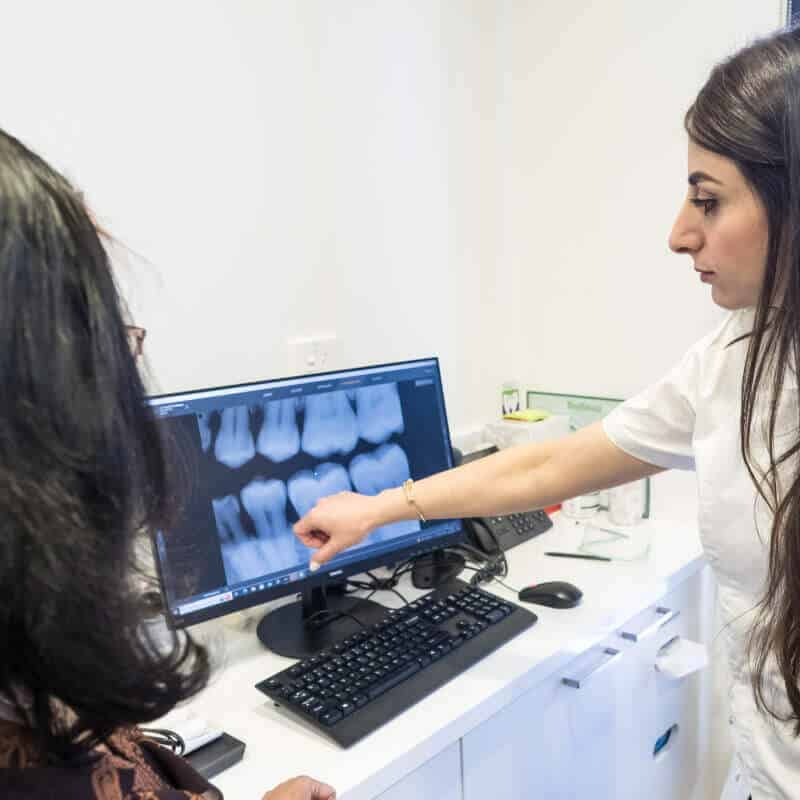  Tooth Removal Including Wisdom Teeth